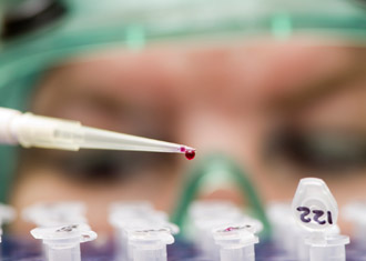 Blood lab work